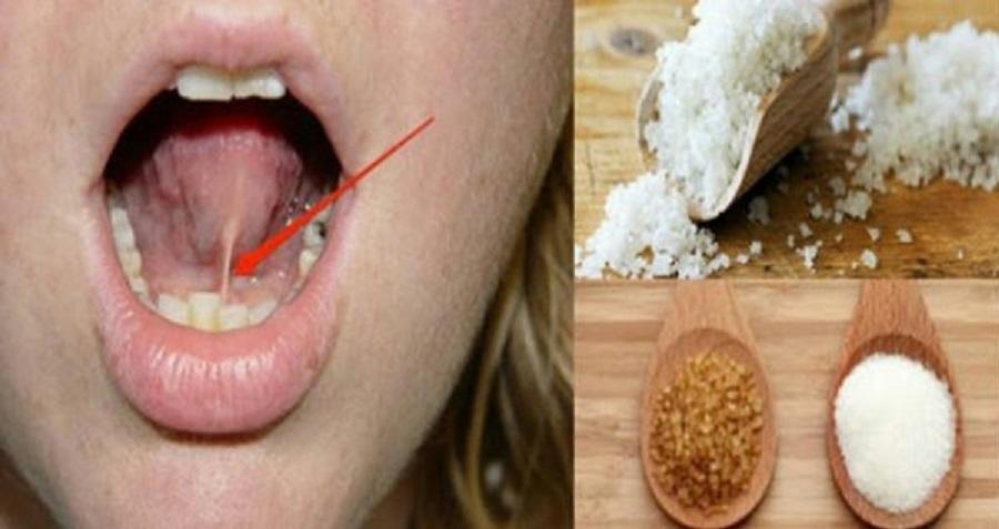 Просто поместите солево-сахарную смесь под языком перед тем, как .