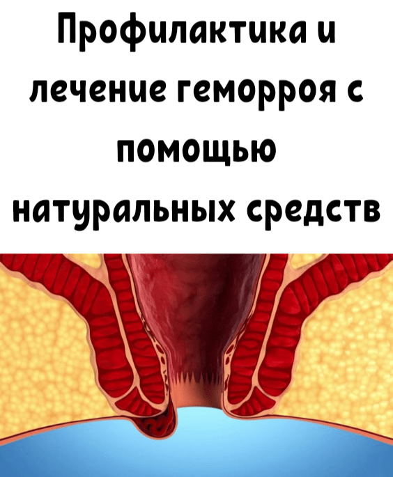 Профилактика геморроя картинки